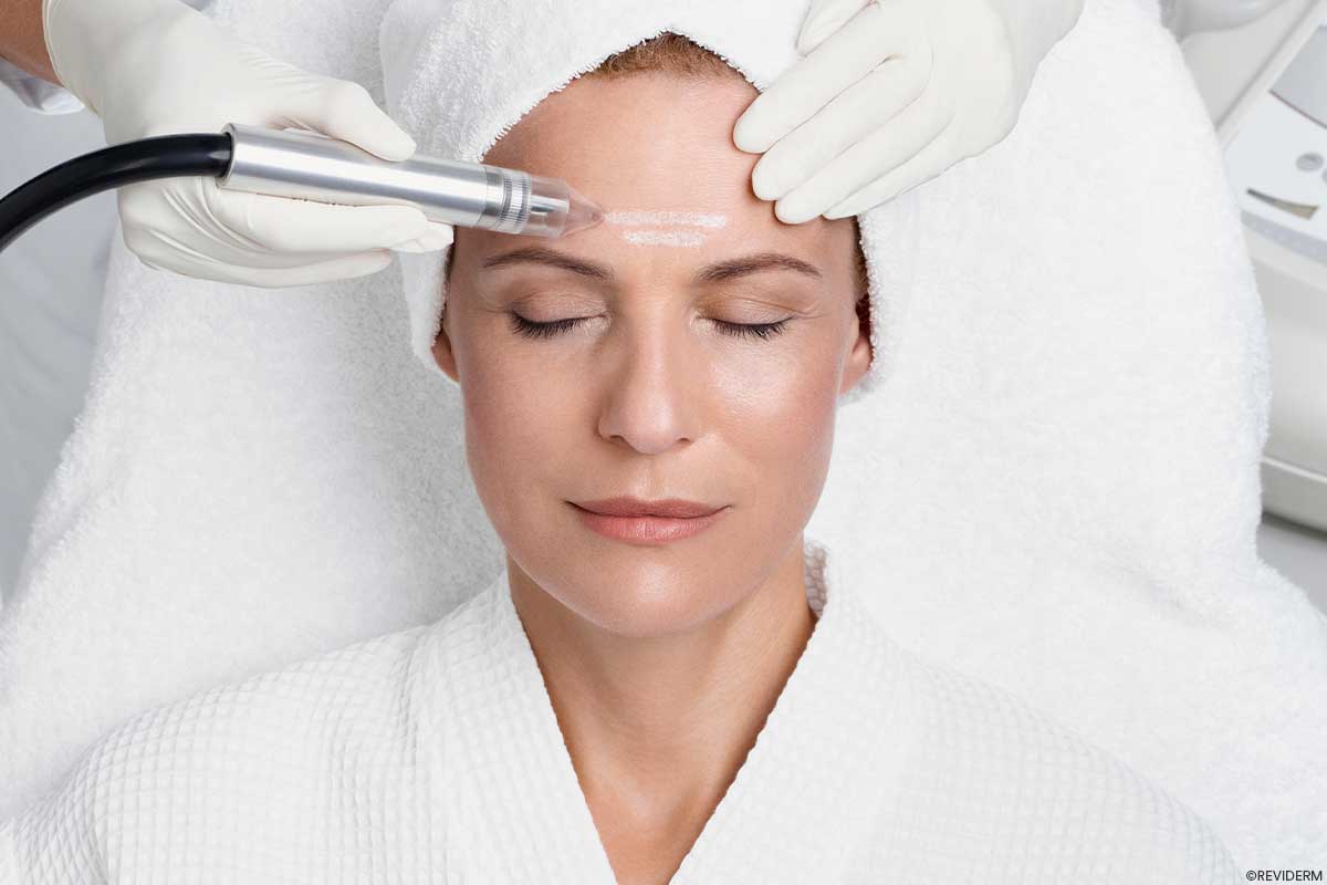 mikrodermabrasion